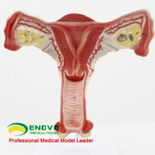 VERKAUF 12443 Modell Gebärmutter zeigen weibliche Genitalstrukturen Gebärmutter-Anatomie-Modell